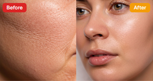 Before and after skin